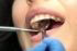 Rescue Dentist Dental Services
