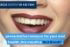 Dental Crowns Whangarei