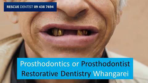 Prosthodontics or Prosthodontist Restorative Dentistry Whangarei